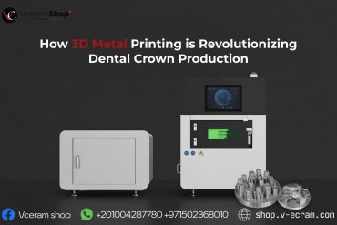 How 3D Metal Printing is Revolutionizing Dental Crown Production